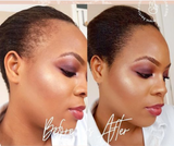 Kit de Repousse Cheveux - Huile Capillaire + Derma roller