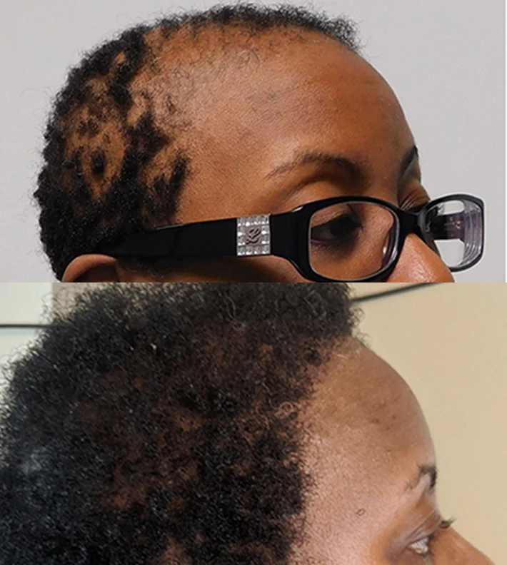 Huile de Batana™ 100% pure | L'huile de croissance des cheveux, de traitement capillaire pour tous les types de cheveux