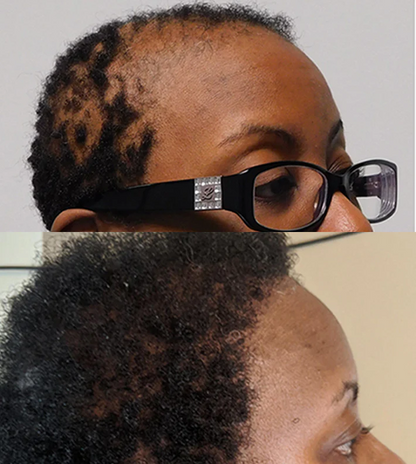 Huile de Batana™ 100% pure | L'huile de croissance des cheveux, de traitement capillaire pour tous les types de cheveux