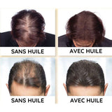 Kit de Repousse Cheveux - Huile Capillaire + Derma roller